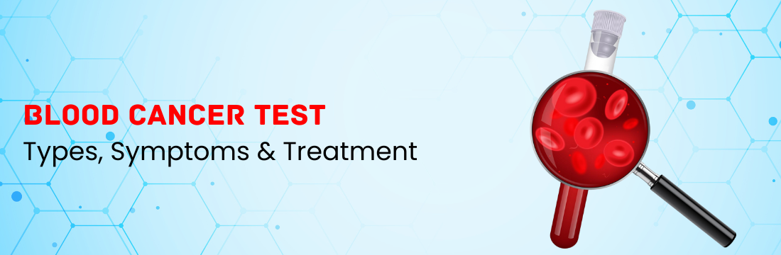 Blood Cancer Types, Symptoms & Treatment